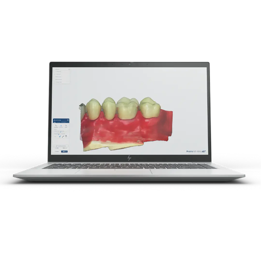 [181500] Ceramill Mind DRS